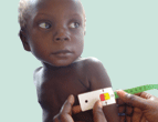 What Works when Treating Acute Malnutrition